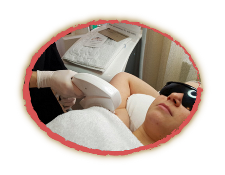 Dream Beauty, DIODENLASER